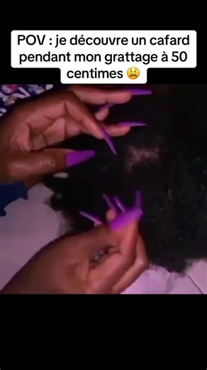 Oh my god a voir jusqu’à la fin! Bonjour à tous aujourd’hui nouvelle vidéo sur ma cliente, soin des cheveux et grattage en ASMR, limiter les démangeaisons et fortifier le cure chevelu