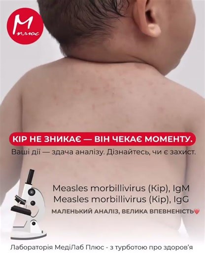 У складний епідеміологічний період: чи є у вас захист? 🛡️