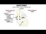 Arrhythmia Overview - Mechanism of Bradyarrhythmia and Tachyarrhythmia • Video • MEDtube.net