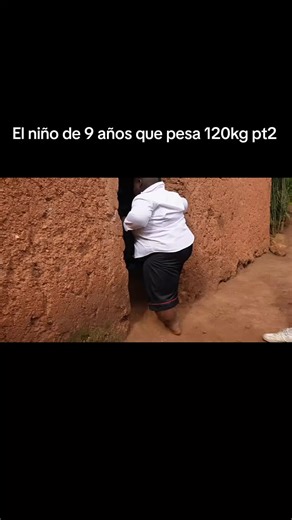 El niño de 9 años con sobrepeso: historia impactante