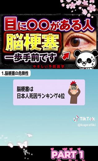 脳梗塞の前兆｜目に現れる危険な異変と見分け方