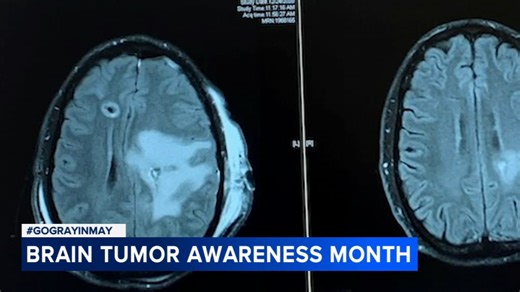 American Brain Tumor Association celebrates the close of Brain Tumor Awareness Month