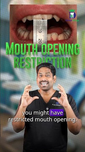 4 விரல்கள் அளவிற்கு வாய் திறக்க முடிகிறதா? - Restricted mouth opening | Dr.karthikeyan | Denta Kings