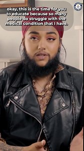 Embracing uniqueness, a bearded lady's perspective