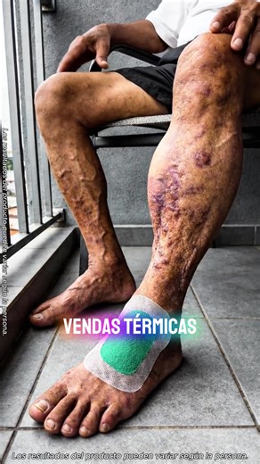 Detox Your Feet with Foot Cleansing Patches