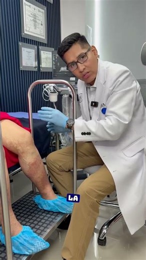 ✨ The right way to treat varicose veins #vascularhealth #varicoseveins