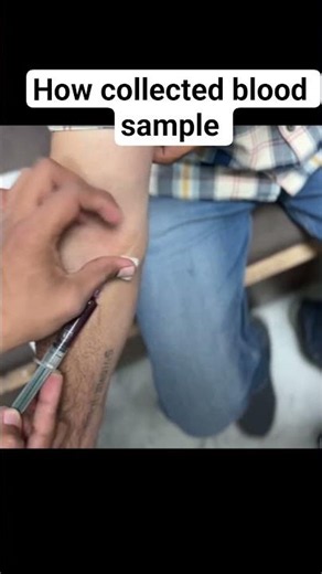How to collect blood sample #shortvideo #MedicalLabScience #MLT #EducationalVideo #YouTubePolicySafe