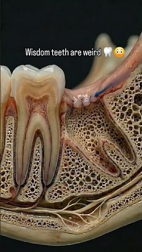 Wisdom Teeth Removal Explained! 🦷👩‍⚕️ #health