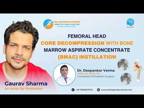 Hip Replacement Avoided? | Core Decompression with BMAC Explained by Dr Deepankar Verma