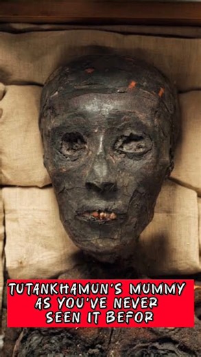 Tutankhamun’s Mummy — As You’ve Never Seen It Before Behind the legendary golden mask lies something far more powerful: the preserved body of the young king himself. Tutankhamun died around the age of 18 or 19 during the late 18th Dynasty. When his tomb (KV62) was discovered in 1922 by Howard Carter, the world focused on gold. But the mummy of the king told a different story — one revealed through anatomy, radiology, and modern DNA analysis. CT scans conducted in the 21st century provided unprec