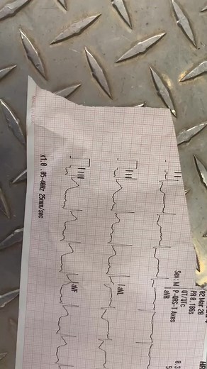 😮😬😮😬 #ekg #ems #code3 #stemi #electrocardiogram #emt #paramediclife