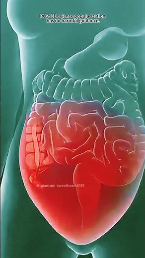 Appendectomy symptoms(3D Animation)