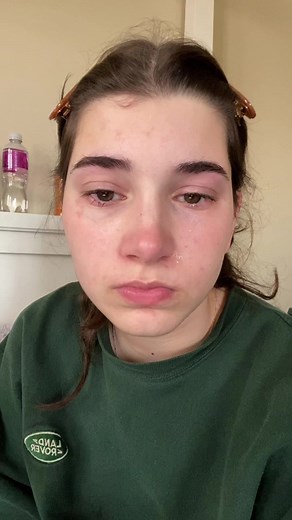 Red Spots on Face When Crying: Causes and Remedies