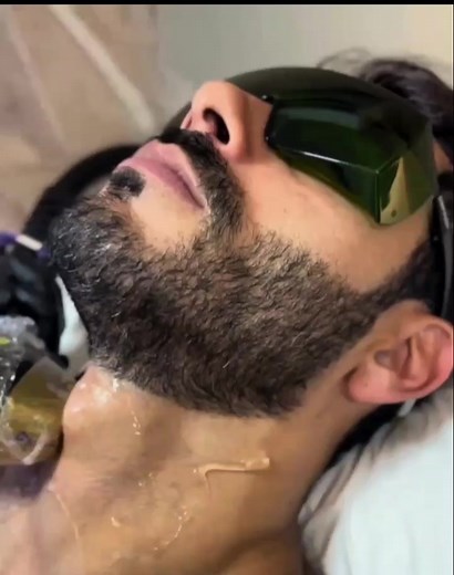 The giant Adam's apple by Rodolffo Matthaus. #adamsapple #adamsapplechallenge