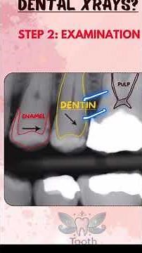 how to read dental x-ray/ radiograph?