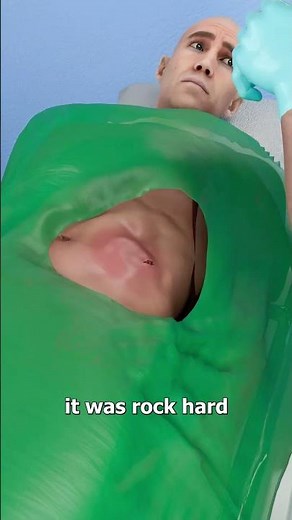 The Eel That Lived In His Belly 🤢