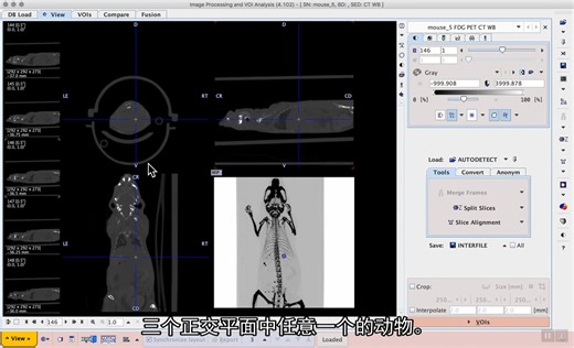 医学图像处理和分析软件 PMod（S1E8）：VOI-based masking for improved 3D rendering