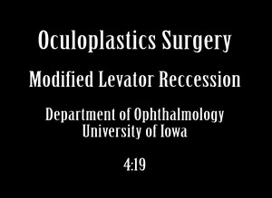 Modified Levator Recession