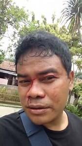 ...korban benang layangan putus... njiiir... 😅😅