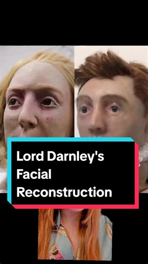 Facial Reconstruction of Lord Darnley and Historical Links