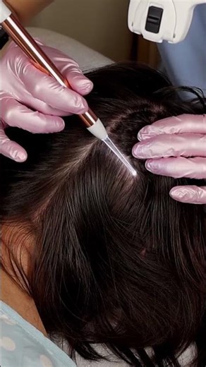 Ultimate ASMR Scalp Inspection with Hair Parting | Manual Skin Check #asmr #short #shorts