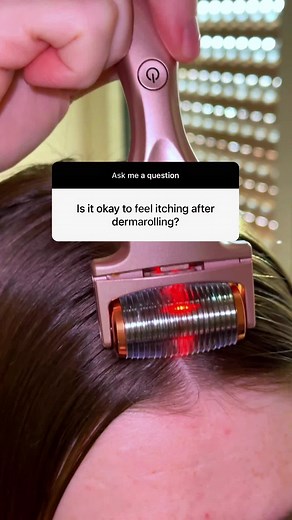 A bit of itching right after use is okay. It should not be intense and prolonged. Ensure you’re keeping things clean and following the proper dermarolling care routine. 🩷 Check if you’re doing everything correctly: \t1.\tEnsure proper cleaning of the dermaroller before and after each use. \t2.\tFor at-home use, avoid dermarollers with needles longer than 0.5 mm. \t3.\tPart your hair before using. \t4.\tRoll the dermaroller carefully and slowly, in small sections, one direction at a time, coveri