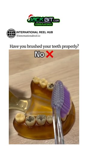 🌍 INTERNATIONAL REEL HUB on Instagram: "The post features a 15-second video using a stained dental model to contrast incorrect (straight-line scrubbing) and correct (angled, circular strokes near gums) toothbrushing, promoting better oral hygiene awareness. This technique mirrors the Bass method, a gold standard for plaque removal, with peer-reviewed studies (e.g., 2020 RCT in J Indian Soc Periodontol) showing it reduces plaque by up to 57% more than rolling or Fones methods. With over 1.1 mill