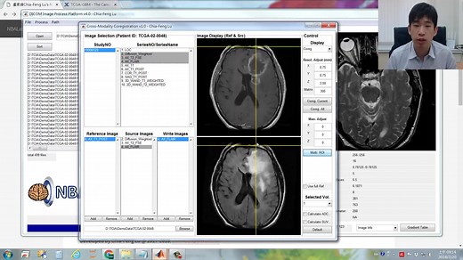 【官方授权】【影像组学radiomics】4\多模态ROI和阈值/Multi-modality ROI and Thresholding