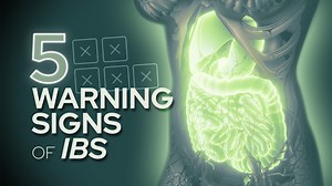 1.6K views · 18 reactions | 5 Warning Signs of Severe IBS Would you...