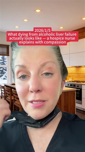 Understanding Alcoholic Liver Failure Symptoms