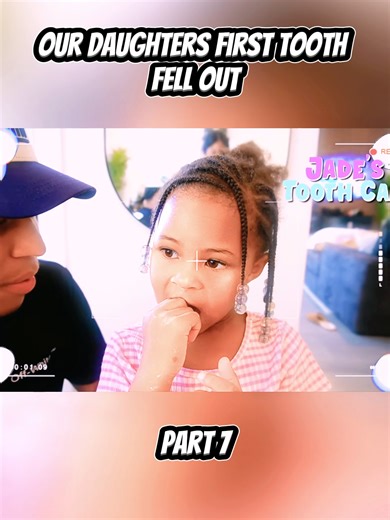Our Daughters First Tooth Fell Out#love #viral #tiktok #foryou | teeth falling out