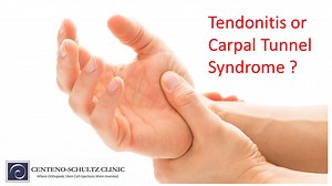 Tendonitis vs Carpal Tunnel: Identifying Important Differences