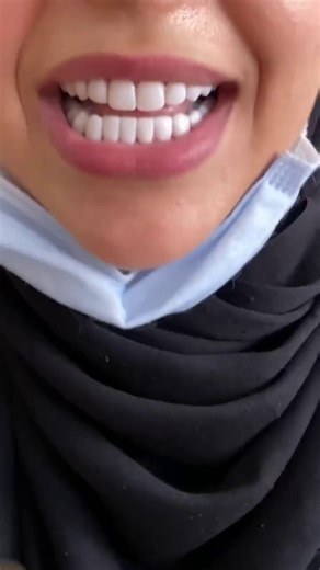 3.1K views | Invisible braces explained: what to know before treatment – Learn more | The Loophole | Facebook