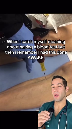 Myro Figura MD | Anesthesiologist 💉 on Instagram: "Have you heard of this before? #medical #surgery #doctorexplains #iv"