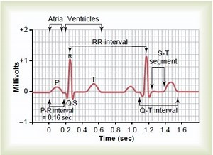 How to read a normal ECG(Electrocardiogram)?