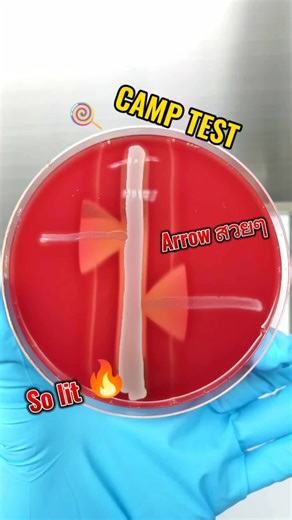 CAMP TEST #campteststreptococcus #diagnosis #Laboratory #bacteria #microbiology