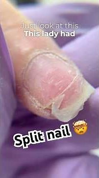Fixing nail split in half 😑😤 #nailtransformation