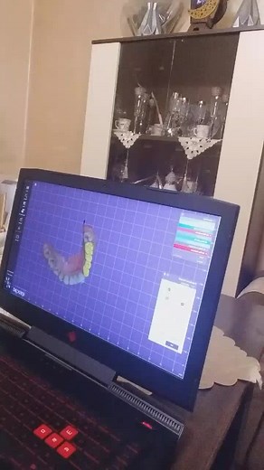 Exocad design online على TikTok