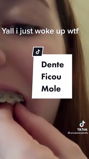 Dente Mole Com Aparelho: É Normal?