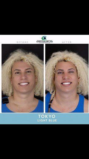 Eyes Color Lab | Incredible transformation! 🌟 Witness how eye color can be beautifully and safely changed at EyeColor Lab. ✨ Discover the magic of... | Instagram