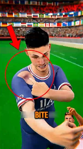 The Most SHOCKING Bite in Football History 😱