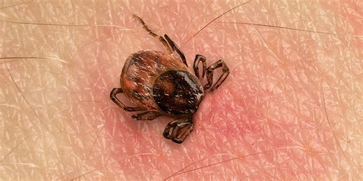 Here’s Exactly What You Should Do If You Find a Tick on Your Body