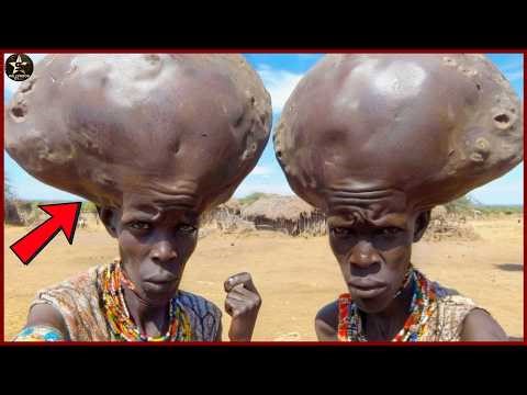 20 Unbelievable Human Cases in Africa That Shocked Doctors