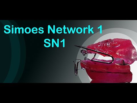 SN1 Production | Simoes Network 1