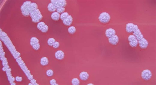 Bacteria behind rare disease found in United States for first time ever, CDC issues health advisory