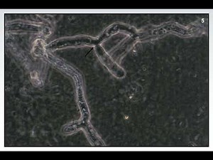 Fundamentals of Plant Diseases - Slide 5 - FUNGI: HYPHAE