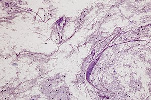 Motor Neuron, Spinal cord, Nerve fibres and nerve cells under the...