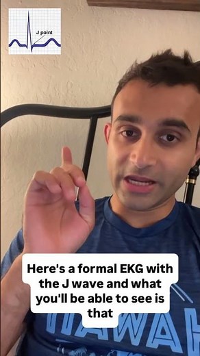 Osborn Waves: The Hypothermia Hack You Can’t Miss!