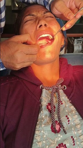 Inferior alveolar nerve block ll local anaesthesia #dentistry #injection #ianblock