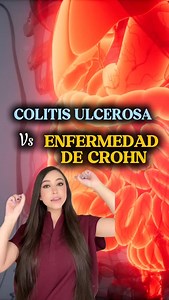 Colitis ulcerosa vs enfermedad de Crohn ¿cuál es la diferencia? 👩🏻‍⚕️ #colitisulcerosa #enfermedaddecrohn #saludintestinal #medicina #drapauzúñiga | Dra. Paulina Zúñiga
